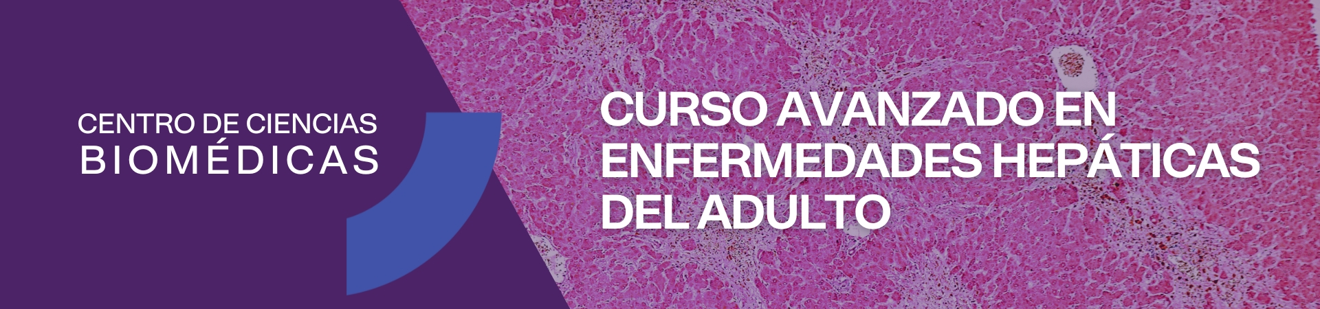 Curso avanzado en Enfermedades Hepáticas del Adulto